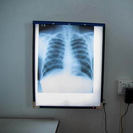 X-ray film view box